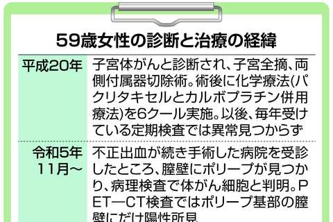 子宮体がん、手術から１５年後に転移が発覚　治療は化学療法より放射線で