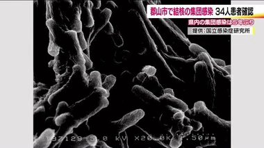 《結核》郡山市の高齢者施設で34人が集団感染　うち4人が発病　医療機関でも男性職員1人が感染・発病　