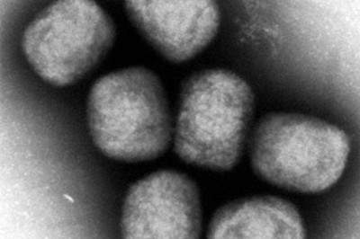 米国で重症型エムポックスの患者を初確認　東アフリカへ渡航歴