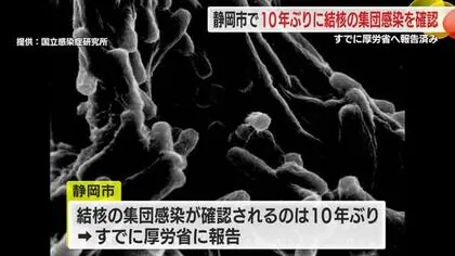 結核の集団感染　静岡市としては10年ぶりの確認　すでに厚労省に報告済み　初発患者以外は発病なし