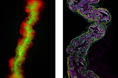 ヒトiPS細胞から管状のミニ腸作製　世界初　東京科学大